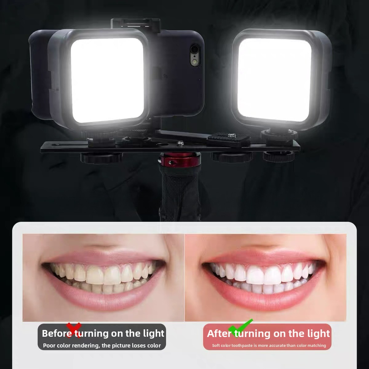 Dental Photography Light with  - đánh giá và giá Photography Basics